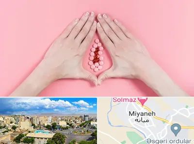 دکتر سرطان واژن در میانه