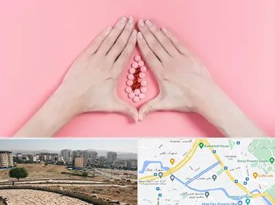 دکتر سرطان واژن در کوی وحدت شیراز 