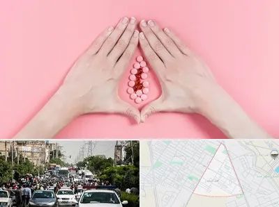 دکتر سرطان واژن در سیدی مشهد