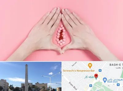 دکتر سرطان واژن در فلکه گاز شیراز 