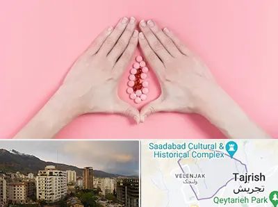 دکتر سرطان واژن در زعفرانیه 