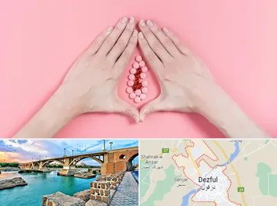 دکتر سرطان واژن در دزفول