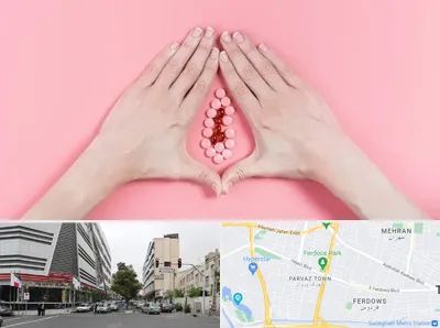 دکتر سرطان واژن در بلوار فردوس 