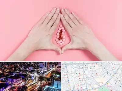 دکتر سرطان واژن در منظریه رشت 