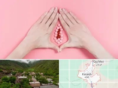 دکتر سرطان واژن در کلاله
