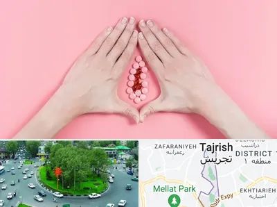 دکتر سرطان واژن در تجریش 