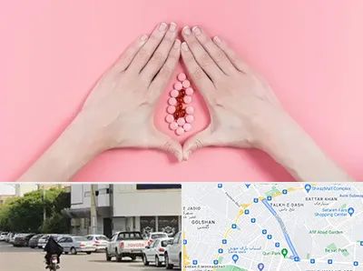 دکتر سرطان واژن در قدوسی شرقی شیراز 