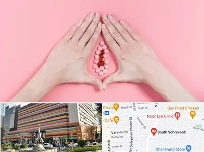 دکتر سرطان واژن در سهروردی 