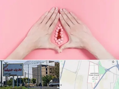 دکتر سرطان واژن در فاز یک اندیشه