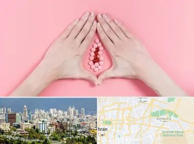 دکتر سرطان واژن در شرق تهران 