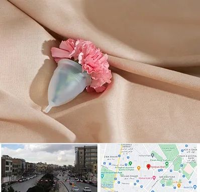 جراح سرطان واژن در بلوار فردوسی مشهد 