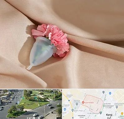 جراح سرطان واژن در شاهین ویلا کرج 