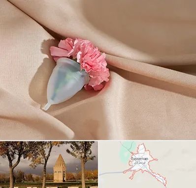 جراح سرطان واژن در تویسرکان