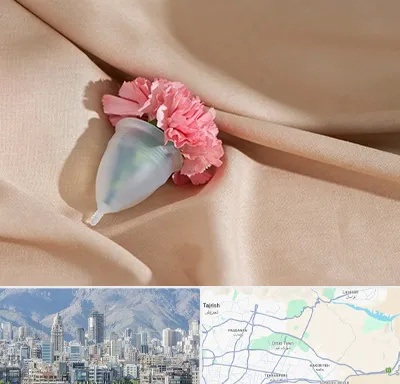 جراح سرطان واژن در شمال شرق تهران