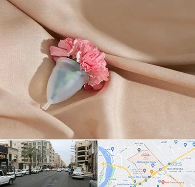 جراح سرطان واژن در زیتون کارمندی اهواز 