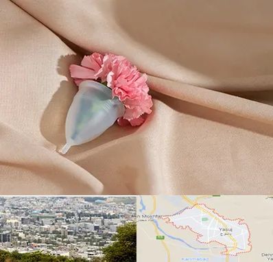 جراح سرطان واژن در یاسوج
