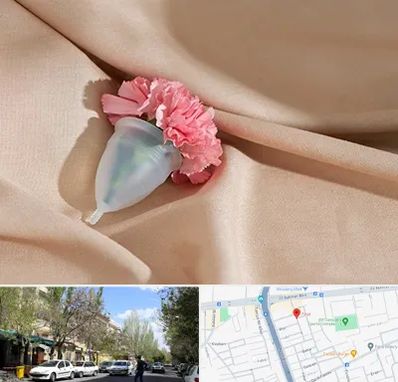 جراح سرطان واژن در کوی فیروز تبریز