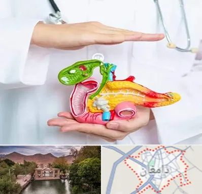 دکتر سرطان لوزالمعده در دامغان