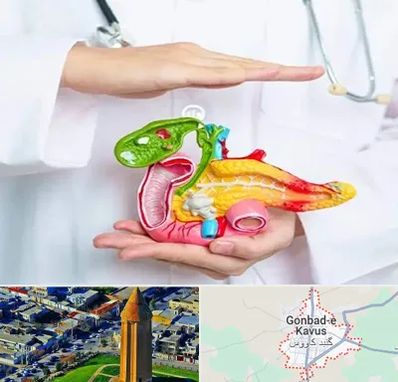 دکتر سرطان لوزالمعده در گنبد کاووس