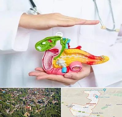 دکتر سرطان لوزالمعده در دماوند