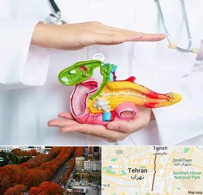 دکتر سرطان لوزالمعده در ولیعصر 