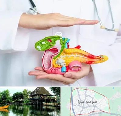 دکتر سرطان لوزالمعده در صومعه سرا