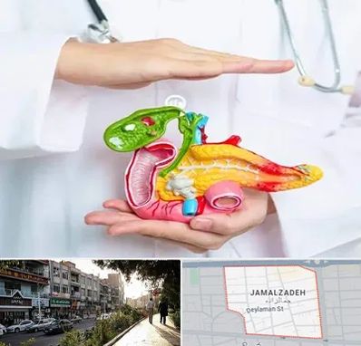 دکتر سرطان لوزالمعده در خیابان جمالزاده