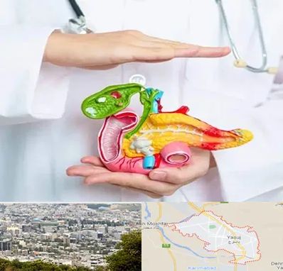 دکتر سرطان لوزالمعده در یاسوج