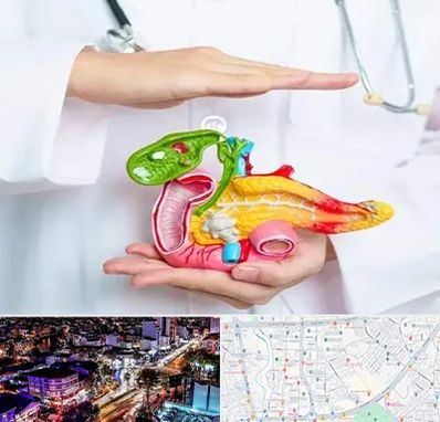 دکتر سرطان لوزالمعده در منظریه رشت 