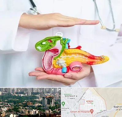 دکتر سرطان لوزالمعده در عظیمیه کرج 