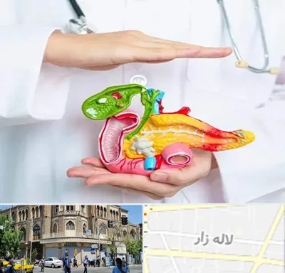 دکتر سرطان لوزالمعده در لاله زار