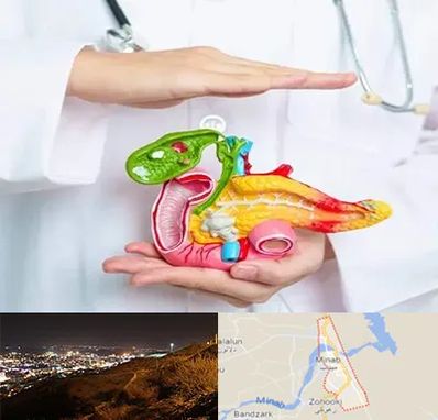 دکتر سرطان لوزالمعده در میناب