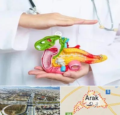 دکتر سرطان لوزالمعده در اراک
