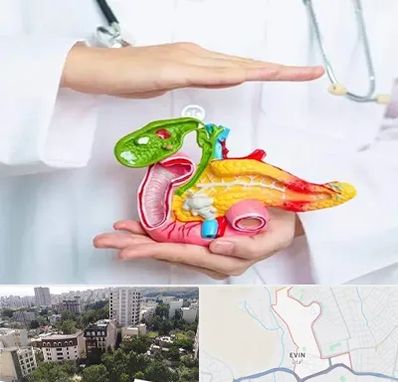 دکتر سرطان لوزالمعده در اوین