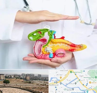 دکتر سرطان لوزالمعده در کوی وحدت شیراز 