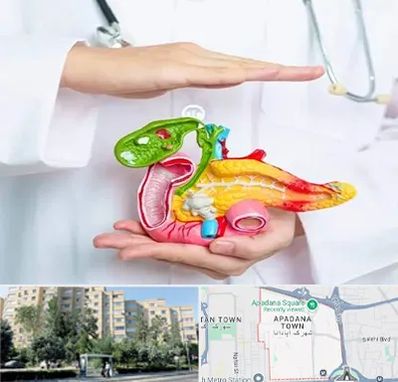 دکتر سرطان لوزالمعده در آپادانا