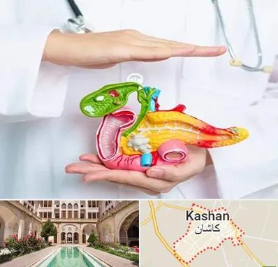 دکتر سرطان لوزالمعده در کاشان