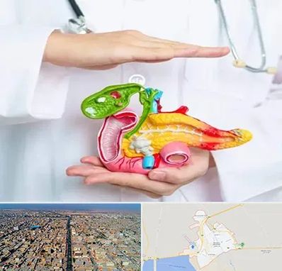 دکتر سرطان لوزالمعده در بندر ماهشهر