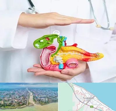 دکتر سرطان لوزالمعده در تنکابن