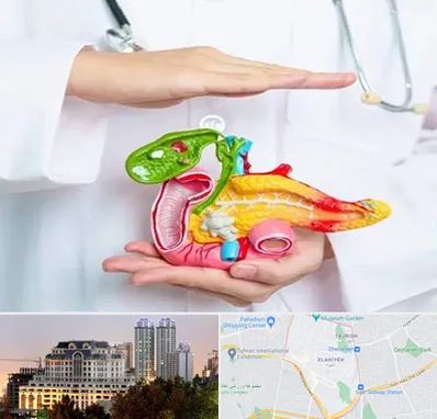 دکتر سرطان لوزالمعده در فرشته 