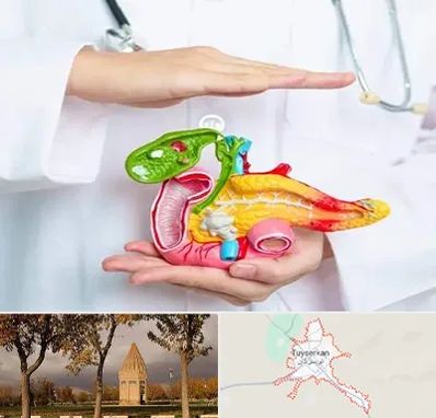 دکتر سرطان لوزالمعده در تویسرکان