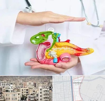 دکتر سرطان لوزالمعده در اسکندری