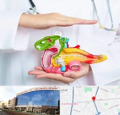 دکتر سرطان لوزالمعده در نصف راه تبریز