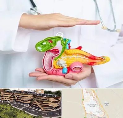 دکتر سرطان لوزالمعده در شاهین شهر