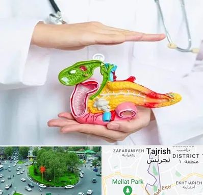 دکتر سرطان لوزالمعده در تجریش 