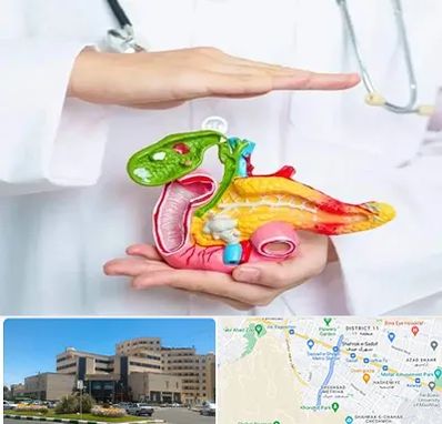 دکتر سرطان لوزالمعده در صیاد شیرازی مشهد 