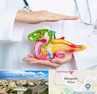 دکتر سرطان لوزالمعده در میانه
