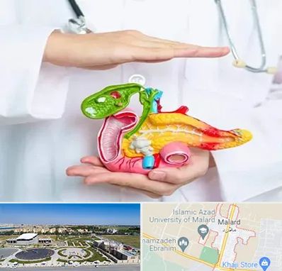 دکتر سرطان لوزالمعده در ملارد