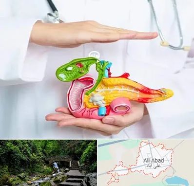 دکتر سرطان لوزالمعده در علی‌ آباد کتول