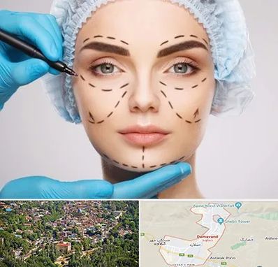جراح پلاستیک در دماوند